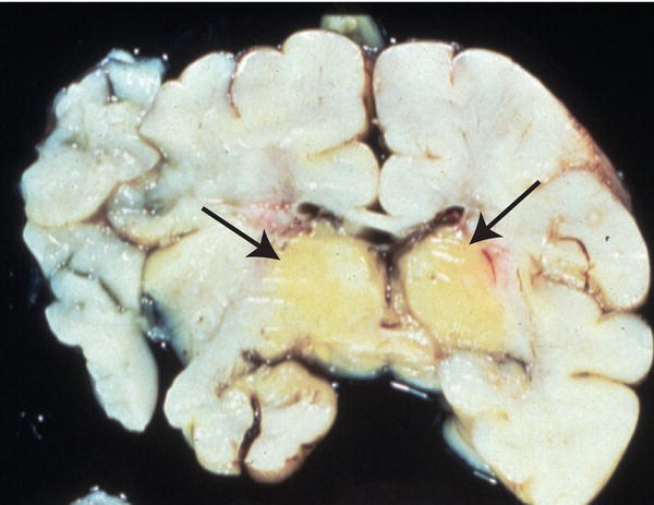 c41-fig-0003