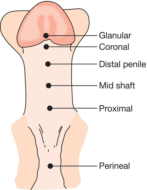 c52-fig-0004