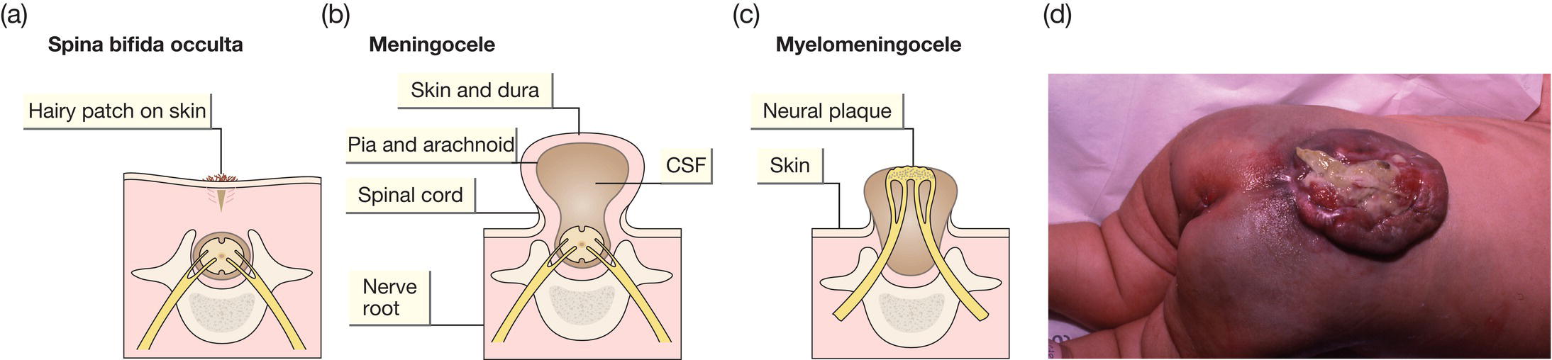 c59-fig-0002