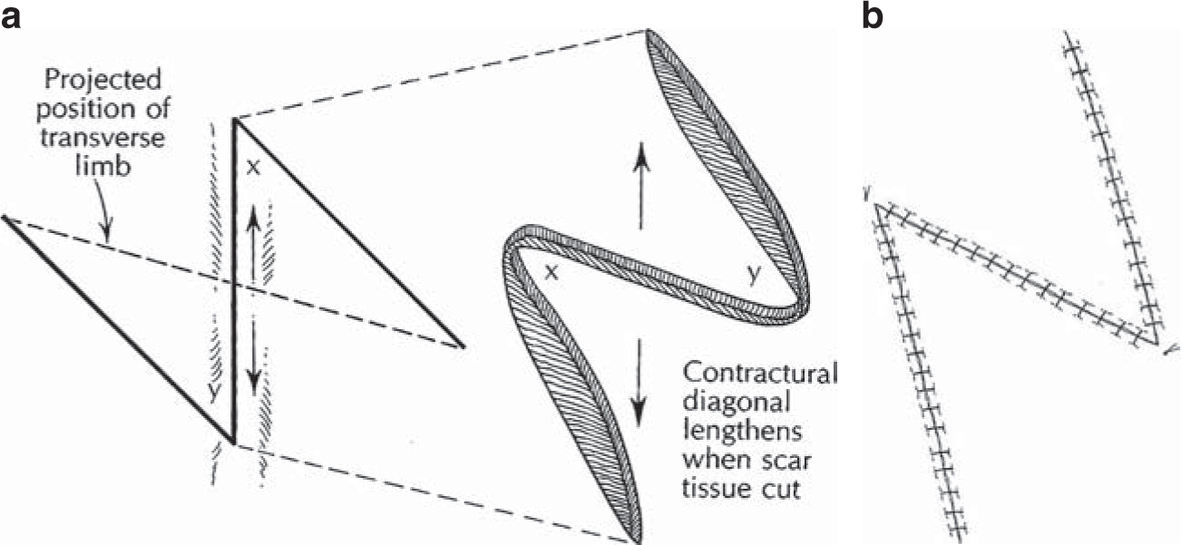 A978-1-84882-513-0_7_Fig20_HTML.jpg