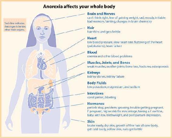 graphic on how Anorexia affects your whole body