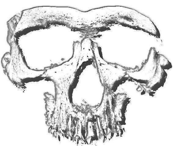 partial skull shadow