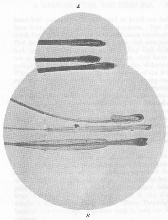 A, SHED HAIRS SHOWING THE NAKED BULB, MAGNIFIED 32 DIAMETERS. B, HAIRS PLUCKED FROM SCALP, SHOWING THE ADHERENT ROOT-SHEATHS, MAGNIFIED 20 DIAMETERS.