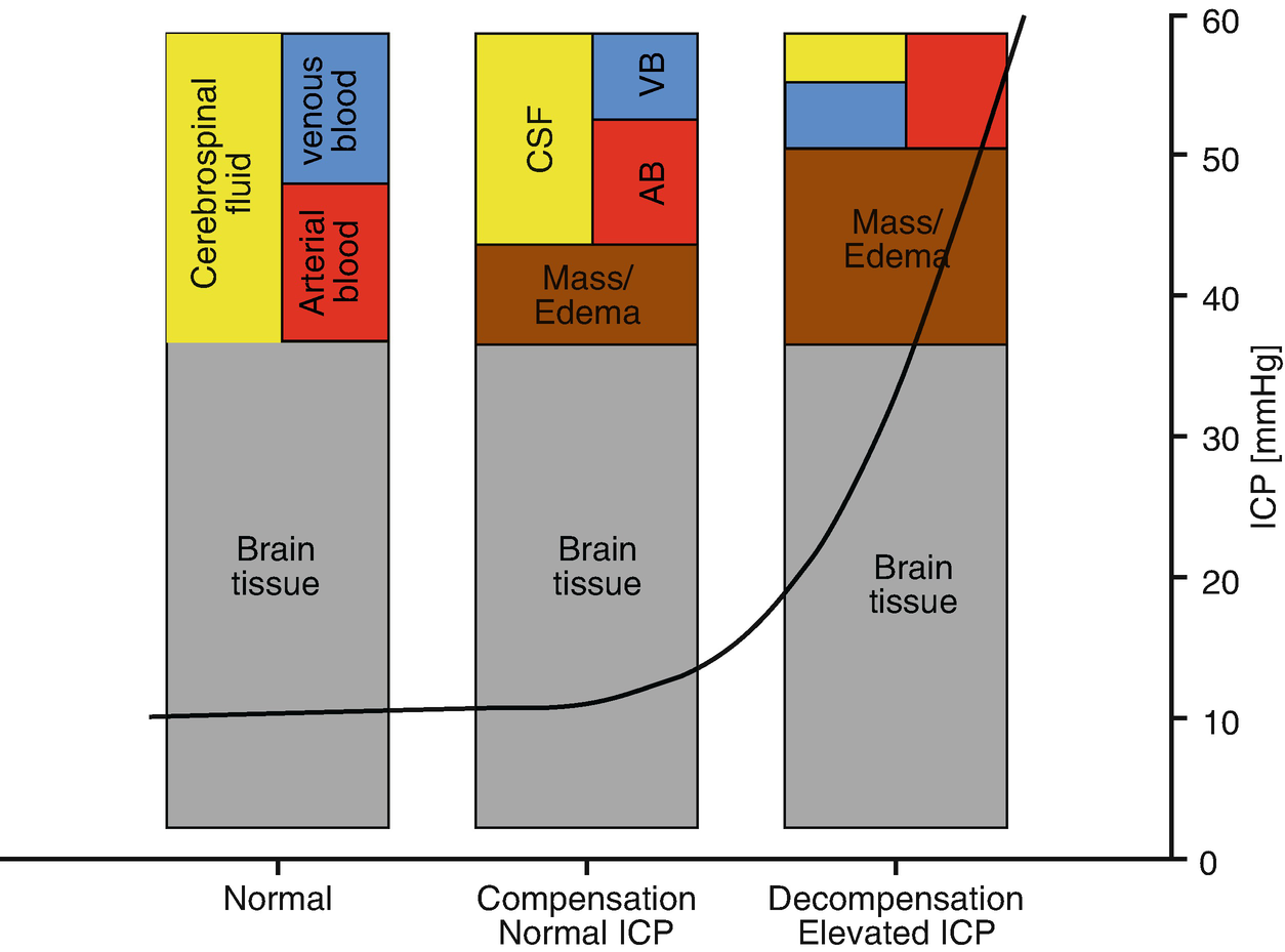 ../images/455944_1_En_11_Chapter/455944_1_En_11_Fig1_HTML.png