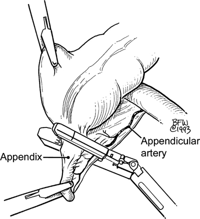 A978-0-387-09515-8_11_Fig15_HTML.jpg