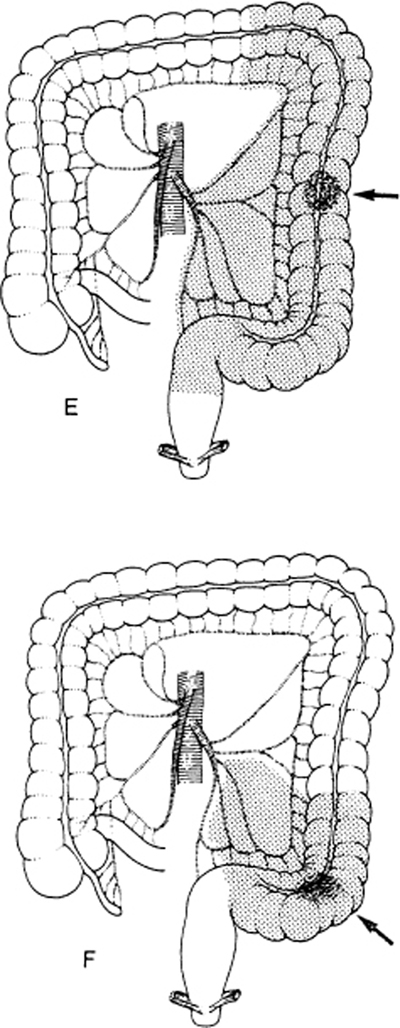 A978-0-387-09515-8_12_Fig19c_HTML.jpg