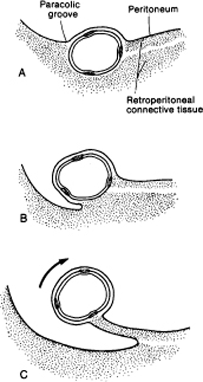 A978-0-387-09515-8_12_Fig2_HTML.jpg