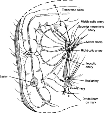 A978-0-387-09515-8_12_Fig40_HTML.jpg