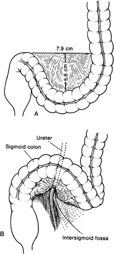 A978-0-387-09515-8_12_Fig5_HTML.jpg