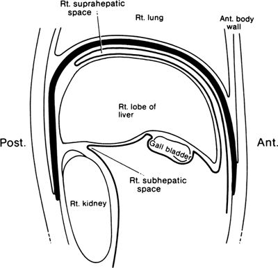 A978-0-387-09515-8_13_Fig15_HTML.jpg