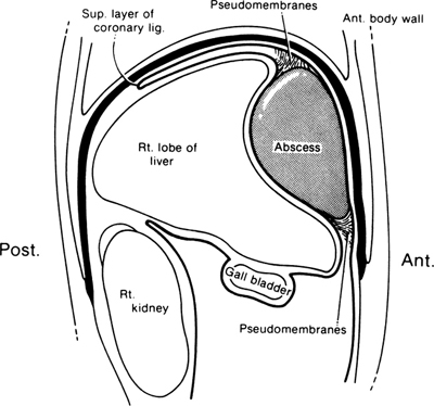 A978-0-387-09515-8_13_Fig17_HTML.jpg