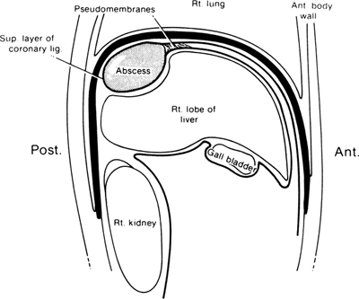 A978-0-387-09515-8_13_Fig18_HTML.jpg