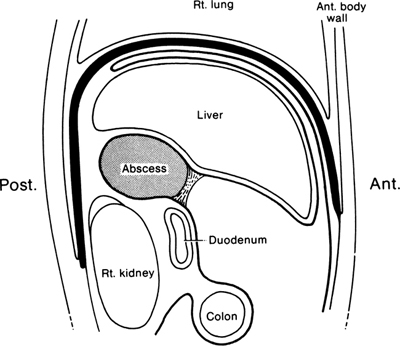 A978-0-387-09515-8_13_Fig21_HTML.jpg