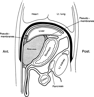 A978-0-387-09515-8_13_Fig22_HTML.jpg