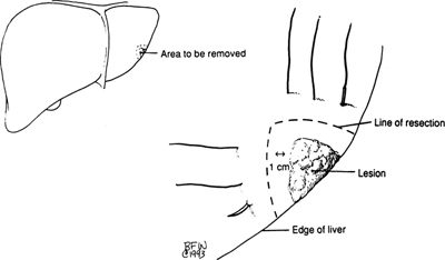 A978-0-387-09515-8_13_Fig23_HTML.jpg