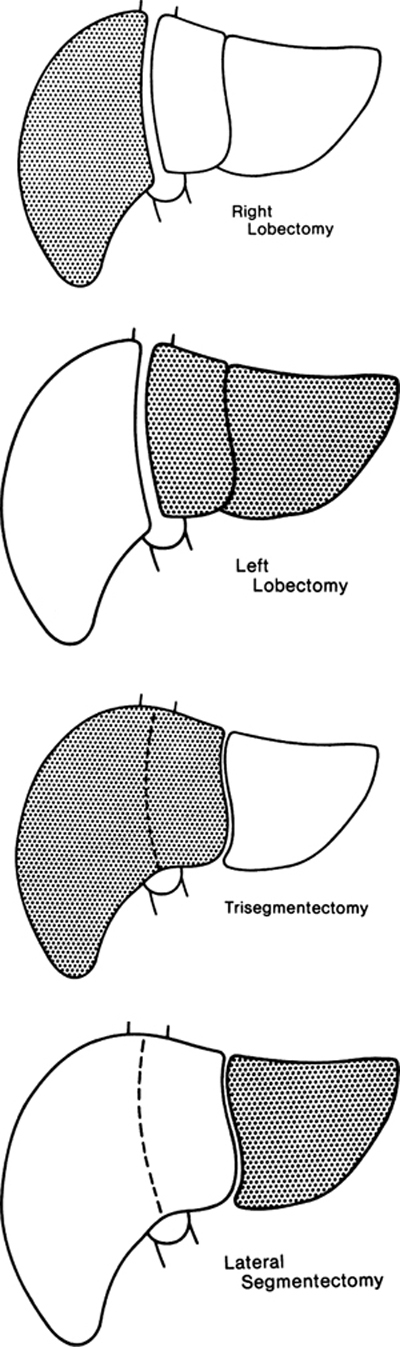 A978-0-387-09515-8_13_Fig26_HTML.jpg