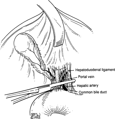 A978-0-387-09515-8_13_Fig39_HTML.jpg