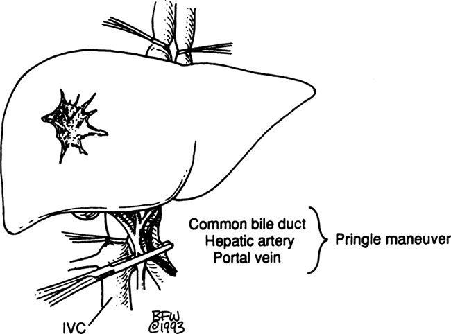 A978-0-387-09515-8_13_Fig40_HTML.jpg