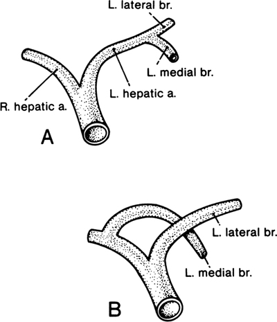 A978-0-387-09515-8_13_Fig9_HTML.jpg