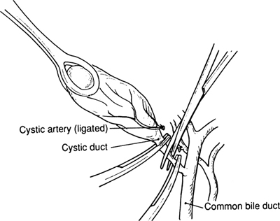 A978-0-387-09515-8_14_Fig12_HTML.jpg