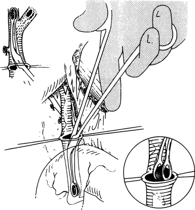 A978-0-387-09515-8_14_Fig26_HTML.jpg