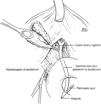 A978-0-387-09515-8_14_Fig33_HTML.jpg