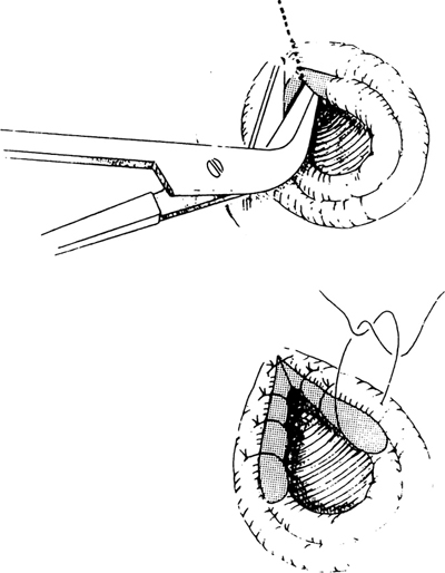 A978-0-387-09515-8_14_Fig36_HTML.jpg