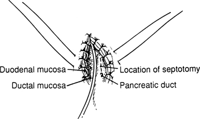 A978-0-387-09515-8_14_Fig37_HTML.jpg