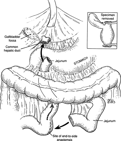 A978-0-387-09515-8_14_Fig44_HTML.jpg