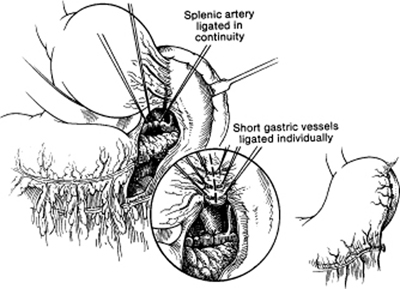 A978-0-387-09515-8_15_Fig13_HTML.jpg