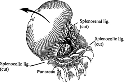 A978-0-387-09515-8_15_Fig14_HTML.jpg