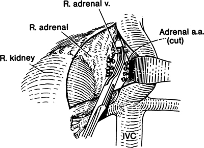 A978-0-387-09515-8_16_Fig10_HTML.jpg