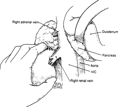 A978-0-387-09515-8_16_Fig11_HTML.jpg