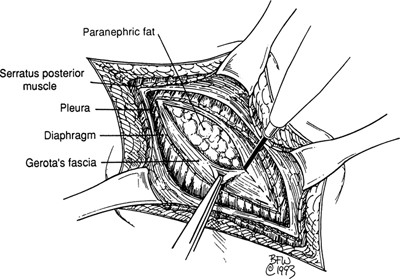 A978-0-387-09515-8_16_Fig15_HTML.jpg