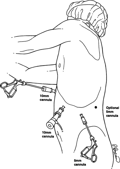 A978-0-387-09515-8_16_Fig22_HTML.jpg