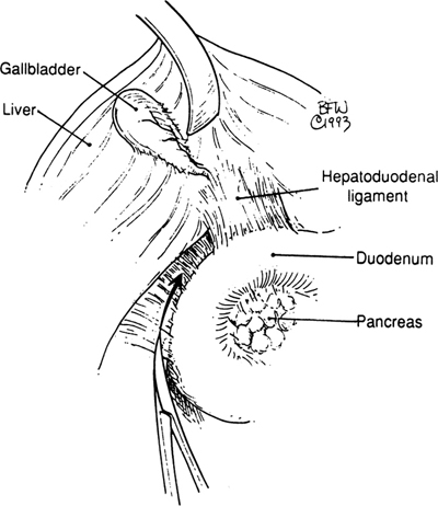 A978-0-387-09515-8_16_Fig9_HTML.jpg