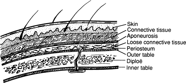 A978-0-387-09515-8_1_Fig2_HTML.jpg