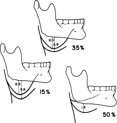 A978-0-387-09515-8_2_Fig3_HTML.jpg