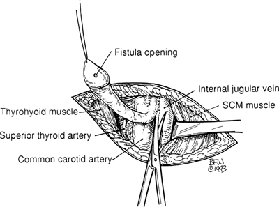 A978-0-387-09515-8_2_Fig60_HTML.jpg