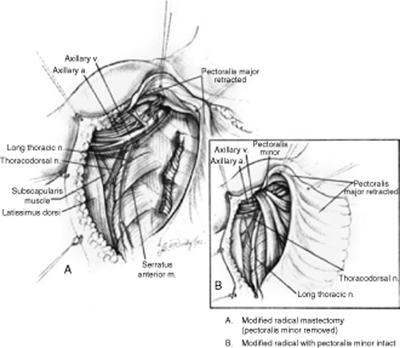 A978-0-387-09515-8_3_Fig16_HTML.jpg