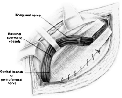 A978-0-387-09515-8_4_Fig100_HTML.jpg