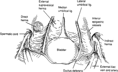 A978-0-387-09515-8_4_Fig22_HTML.jpg