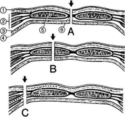 A978-0-387-09515-8_4_Fig39_HTML.jpg