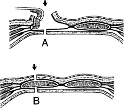 A978-0-387-09515-8_4_Fig40_HTML.jpg