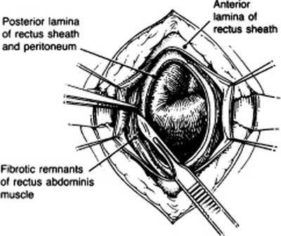 A978-0-387-09515-8_4_Fig44_HTML.jpg