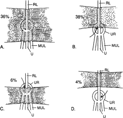 A978-0-387-09515-8_4_Fig4_HTML.jpg