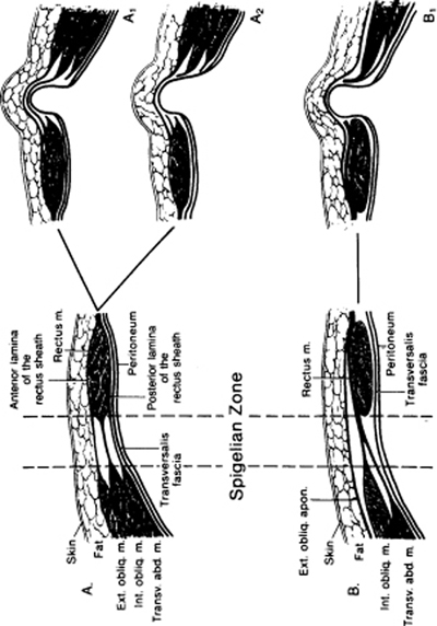 A978-0-387-09515-8_4_Fig56_HTML.jpg