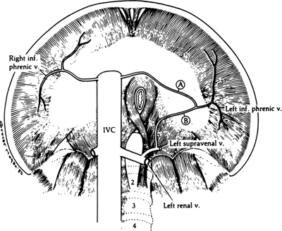 A978-0-387-09515-8_5_Fig12_HTML.jpg