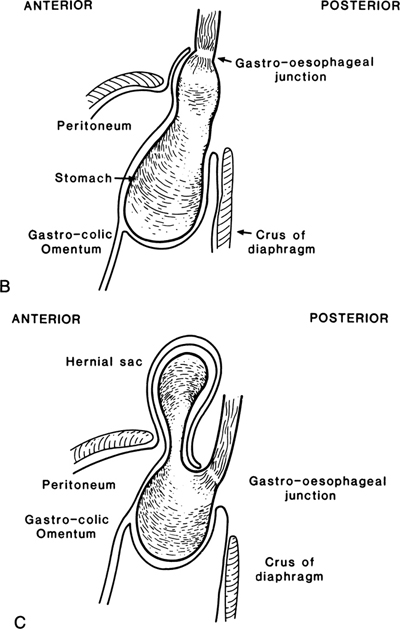 A978-0-387-09515-8_5_Fig17b_HTML.jpg