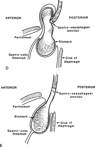 A978-0-387-09515-8_5_Fig17c_HTML.jpg